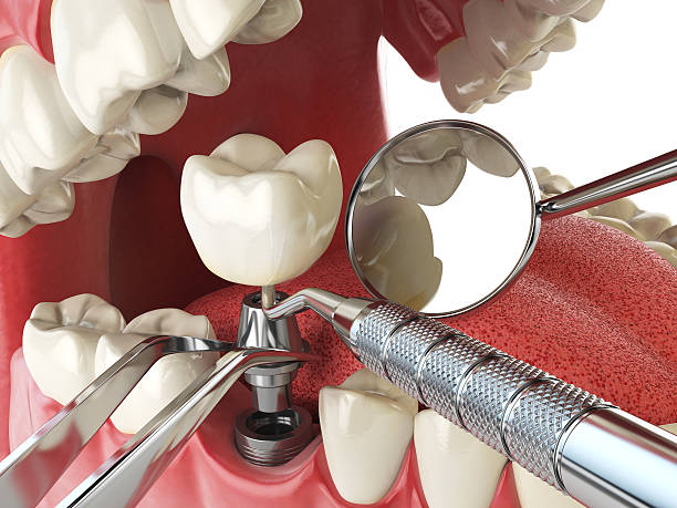 Best Emergency Treatment for Toothache in Byng, OK